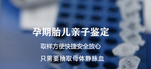 青海孕期亲子鉴定多少钱,青海孕期亲子鉴定如何做